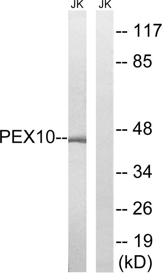 PEX10 Antibody - Western blot analysis of lysates from Jurkat cells, using PEX10 Antibody. The lane on the right is blocked with the synthesized peptide.
