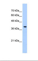 PEX10 Antibody - Transfected 293T cell lysate. Antibody concentration: 0.25 ug/ml. Gel concentration: 12%.  This image was taken for the unconjugated form of this product. Other forms have not been tested.