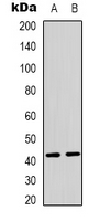 PEX10 Antibody - Western blot analysis of PEX10 expression in MCF7 (A); Jurkat (B) whole cell lysates.