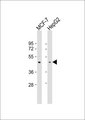 PEX10 Antibody - All lanes: Anti-PEX10 Antibody at 1:1000 dilution. Lane 1: MCF-7 whole cell lysate. Lane 2: HepG2 whole cell lysate Lysates/proteins at 20 ug per lane. Secondary Goat Anti-Rabbit IgG, (H+L), Peroxidase conjugated at 1:10000 dilution. Predicted band size: 37 kDa. Blocking/Dilution buffer: 5% NFDM/TBST.