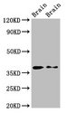 PEX10 Antibody - Positive Western Blot detected in Rat brain tissue, Mouse brain tissue. All lanes: PEX10 antibody at 2.7 µg/ml Secondary Goat polyclonal to rabbit IgG at 1/50000 dilution. Predicted band size: 38, 40 KDa. Observed band size: 38 KDa