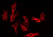 PEX10 Antibody - Staining HeLa cells by IF/ICC. The samples were fixed with PFA and permeabilized in 0.1% Triton X-100, then blocked in 10% serum for 45 min at 25°C. The primary antibody was diluted at 1:200 and incubated with the sample for 1 hour at 37°C. An Alexa Fluor 594 conjugated goat anti-rabbit IgG (H+L) Ab, diluted at 1/600, was used as the secondary antibody.