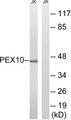 PEX10 Antibody - Western blot analysis of extracts from Jurkat cells, using PEX10 antibody.