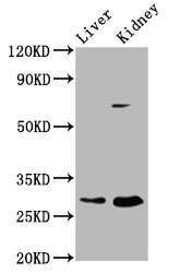 PEX11A Antibody - Western Blot Positive WB detected in: Rat liver tissue, Rat kidney tissue All Lanes: PEX11A antibody at 2.37µg/ml Secondary Goat polyclonal to rabbit IgG at 1/50000 dilution Predicted band size: 29, 25 KDa Observed band size: 29 KDa