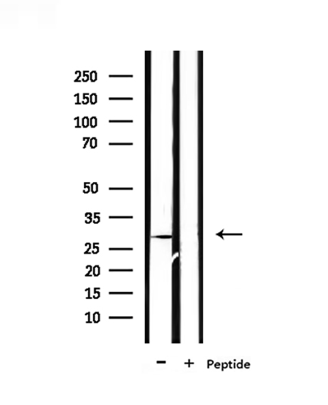 PEX11A Antibody - Western blot analysis of extracts of mouse liver tissue using PEX11A antibody.