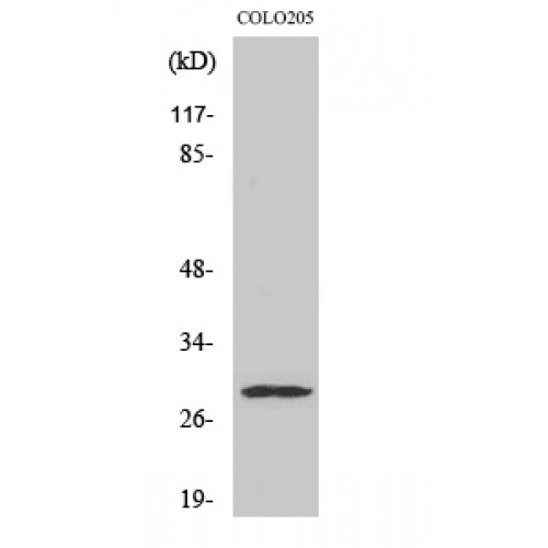 PEX11B Antibody - Western blot of Peroxin 11beta antibody