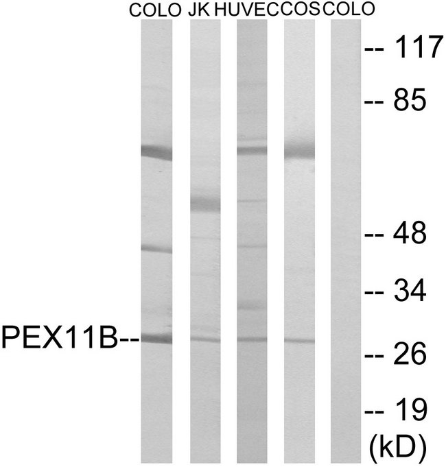 PEX11B Antibody - Western blot analysis of lysates from COLO, HUVEC, COS7, and Jurkat cells, using PEX11B Antibody. The lane on the right is blocked with the synthesized peptide.