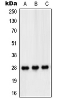 PEX11B Antibody - Western blot analysis of PEX11B expression in HT29 (A); THP1 (B); Jurkat (C) whole cell lysates.