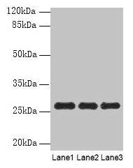 PEX11B Antibody - Western blot All lanes: PEX11B antibody at 10µg/ml Lane 1: 293T whole cell lysate Lane 2: Hela whole cell lysate Lane 3: K562 whole cell lysate Secondary Goat polyclonal to rabbit IgG at 1/10000 dilution Predicted band size: 29, 27 kDa Observed band size: 27 kDa