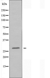 PEX11B Antibody - Western blot analysis of extracts of COLO cells using PEX11B antibody.