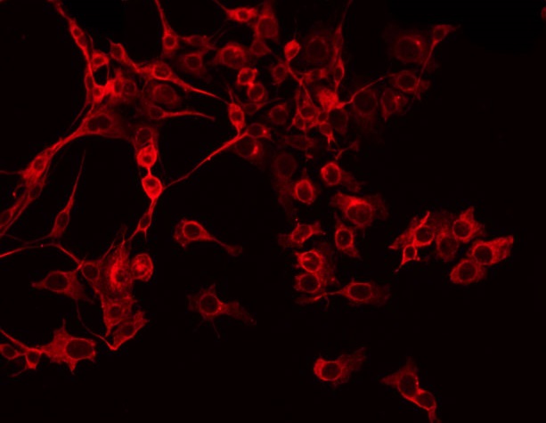 PEX11B Antibody - Staining COLO205 cells by IF/ICC. The samples were fixed with PFA and permeabilized in 0.1% Triton X-100, then blocked in 10% serum for 45 min at 25°C. The primary antibody was diluted at 1:200 and incubated with the sample for 1 hour at 37°C. An Alexa Fluor 594 conjugated goat anti-rabbit IgG (H+L) Ab, diluted at 1/600, was used as the secondary antibody.