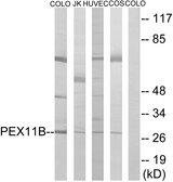 PEX11B Antibody - Western blot analysis of extracts from COLO cells, Jurkat cells, HUVEC cells and COS-7 cells, using PEX11B antibody.