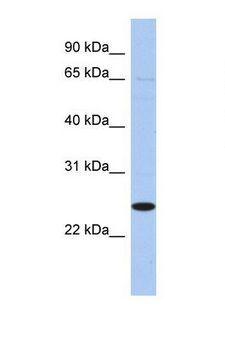 PEX11B Antibody - Western blot of Human THP-1. PEX11B antibody dilution 1.0 ug/ml.  This image was taken for the unconjugated form of this product. Other forms have not been tested.