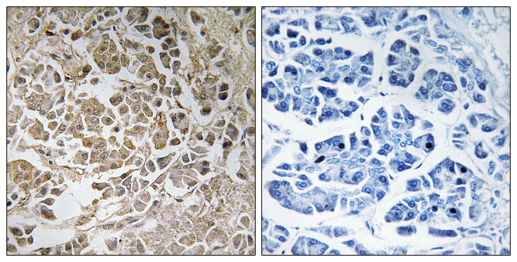PEX11G Antibody - Immunohistochemistry analysis of paraffin-embedded human pancreas, using PEX11C Antibody. The picture on the right is blocked with the synthesized peptide.