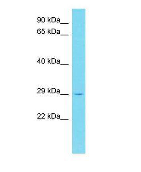 PEX11G Antibody - Western blot of PEX11G Antibody - C-terminal region with human OVCAR-3 cells lysate.  This image was taken for the unconjugated form of this product. Other forms have not been tested.