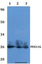 PEX11G Antibody - Western blot of PEX11G antibody at 1:500 dilution Line1:MCF-7 whole cell lysate Line2:PC12 whole cell lysate Line3:sp20 whole cell lysate.