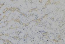 PEX12 Antibody - 1:100 staining mouse kidney tissue by IHC-P. The sample was formaldehyde fixed and a heat mediated antigen retrieval step in citrate buffer was performed. The sample was then blocked and incubated with the antibody for 1.5 hours at 22°C. An HRP conjugated goat anti-rabbit antibody was used as the secondary.