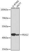 PEX12 Antibody - Western blot analysis of extracts of various cell lines using PEX12 Polyclonal Antibody at dilution of 1:1000.