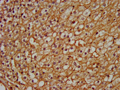 PEX13 Antibody - IHC image of PEX13 Antibody diluted at 1:200 and staining in paraffin-embedded human adrenal gland tissue performed on a Leica BondTM system. After dewaxing and hydration, antigen retrieval was mediated by high pressure in a citrate buffer (pH 6.0). Section was blocked with 10% normal goat serum 30min at RT. Then primary antibody (1% BSA) was incubated at 4°C overnight. The primary is detected by a biotinylated secondary antibody and visualized using an HRP conjugated SP system.