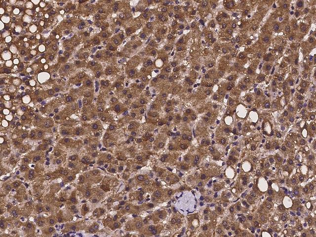 PEX13 Antibody - Immunochemical staining of human PEX13 in human liver with rabbit polyclonal antibody at 1:100 dilution, formalin-fixed paraffin embedded sections.