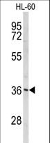 PEX14 Antibody - Western blot of PEX14 Antibody in HL-60 cell line lysates (35 ug/lane). PEX14 (arrow) was detected using the purified antibody.