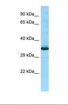 PEX14 Antibody - Western blot of Human 721_B . PEX14 antibody dilution 1.0 ug/ml.  This image was taken for the unconjugated form of this product. Other forms have not been tested.