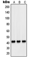 PEX14 Antibody - Western blot analysis of PEX14 expression in HeLa (A); HL60 (B); A431 (C) whole cell lysates.