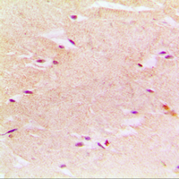 PEX14 Antibody - Immunohistochemical analysis of PEX14 staining in human muscle formalin fixed paraffin embedded tissue section. The section was pre-treated using heat mediated antigen retrieval with sodium citrate buffer (pH 6.0). The section was then incubated with the antibody at room temperature and detected using an HRP conjugated compact polymer system. DAB was used as the chromogen. The section was then counterstained with hematoxylin and mounted with DPX.