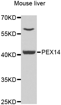 PEX14 Antibody - Western blot analysis of extracts of mouse liver.