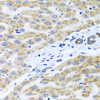 PEX14 Antibody - Immunohistochemistry of paraffin-embedded human liver injury tissue.