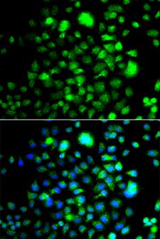 PEX14 Antibody - Immunofluorescence analysis of A549 cells.