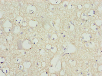 PEX14 Antibody - Immunohistochemistry of paraffin-embedded human brain tissue at dilution 1:100