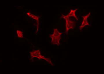 PEX14 Antibody - Staining A549 cells by IF/ICC. The samples were fixed with PFA and permeabilized in 0.1% Triton X-100, then blocked in 10% serum for 45 min at 25°C. The primary antibody was diluted at 1:200 and incubated with the sample for 1 hour at 37°C. An Alexa Fluor 594 conjugated goat anti-rabbit IgG (H+L) Ab, diluted at 1/600, was used as the secondary antibody.