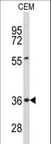PEX16 Antibody - Western blot of PEX16 Antibody in CEM cell line lysates (35 ug/lane). PEX16 (arrow) was detected using the purified antibody.