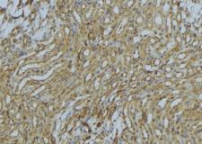 PEX16 Antibody - 1:100 staining mouse kidney tissue by IHC-P. The sample was formaldehyde fixed and a heat mediated antigen retrieval step in citrate buffer was performed. The sample was then blocked and incubated with the antibody for 1.5 hours at 22°C. An HRP conjugated goat anti-rabbit antibody was used as the secondary.