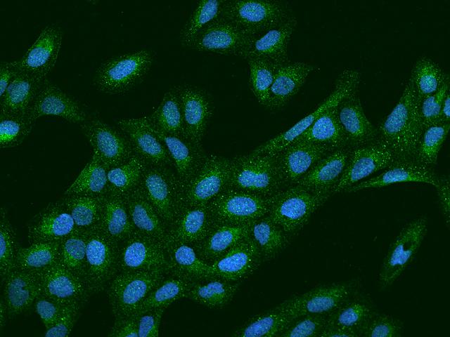 PEX19 Antibody - Immunofluorescence staining of PEX19 in U2OS cells. Cells were fixed with 4% PFA, permeabilzed with 0.1% Triton X-100 in PBS, blocked with 10% serum, and incubated with rabbit anti-Human PEX19 polyclonal antibody (dilution ratio 1:200) at 4°C overnight. Then cells were stained with the Alexa Fluor 488-conjugated Goat Anti-rabbit IgG secondary antibody (green) and counterstained with DAPI (blue). Positive staining was localized to Cytoplasm.