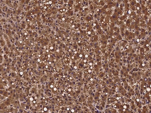 PEX19 Antibody - Immunochemical staining of human PEX19 in human liver with rabbit polyclonal antibody at 1:100 dilution, formalin-fixed paraffin embedded sections.