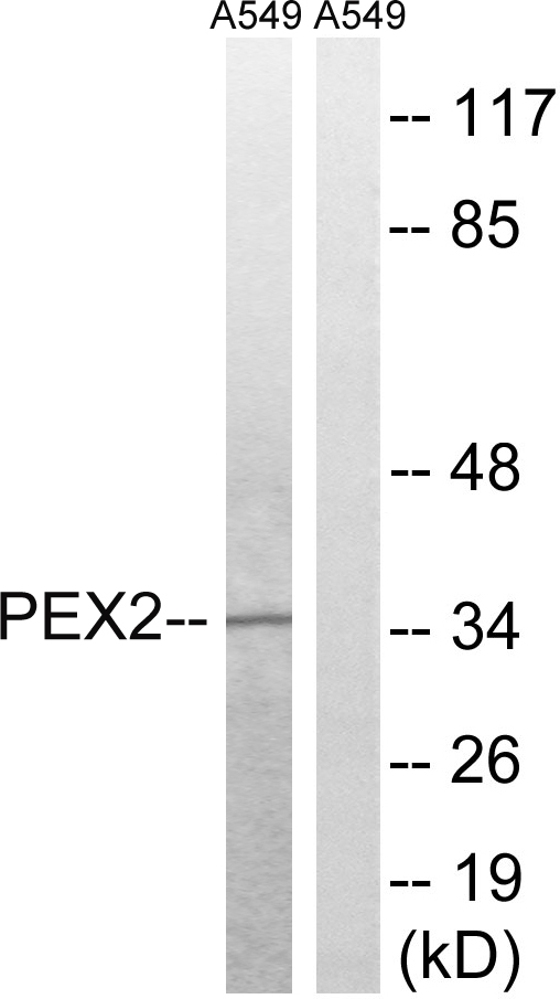 PEX2 / PAF-1 Antibody - Western blot analysis of lysates from A549 cells, using PXMP3 Antibody. The lane on the right is blocked with the synthesized peptide.