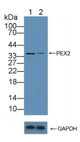PEX2 / PAF-1 Antibody - Knockout Varification: Lane 1: Wild-type Hela cell lysate; Lane 2: PEX2 knockout Hela cell lysate; Predicted MW: 35kd Observed MW: 35kd Primary Ab: 5µg/ml Rabbit Anti-Human PEX2 Antibody Second Ab: 0.2µg/mL HRP-Linked Caprine Anti-Rabbit IgG Polyclonal Antibody