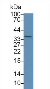 PEX2 / PAF-1 Antibody - Western Blot; Sample: Human Liver lysate; Primary Ab: 5µg/ml Rabbit Anti-Human PEX2 Antibody Second Ab: 0.2µg/mL HRP-Linked Caprine Anti-Rabbit IgG Polyclonal Antibody