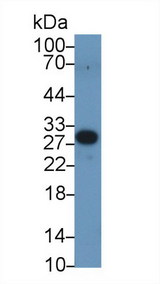 PEX2 / PAF-1 Antibody - Western Blot; Sample: Human Serum; Primary Ab: 1µg/ml Rabbit Anti-Human PEX2 Antibody Second Ab: 0.2µg/mL HRP-Linked Caprine Anti-Rabbit IgG Polyclonal Antibody