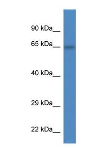 PEX2 / PAF-1 Antibody - PEX2 antibody Western blot of Mouse Liver lysate. Antibody concentration 1 ug/ml. This image was taken for the unconjugated form of this product. Other forms have not been tested.
