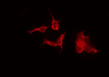PEX2 / PAF-1 Antibody - Staining A549 cells by IF/ICC. The samples were fixed with PFA and permeabilized in 0.1% Triton X-100, then blocked in 10% serum for 45 min at 25°C. The primary antibody was diluted at 1:200 and incubated with the sample for 1 hour at 37°C. An Alexa Fluor 594 conjugated goat anti-rabbit IgG (H+L) Ab, diluted at 1/600, was used as the secondary antibody.