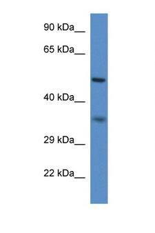 PEX2 / PAF-1 Antibody - PEX2 antibody Western blot of Mouse Spleen lysate. Antibody concentration 1 ug/ml. This image was taken for the unconjugated form of this product. Other forms have not been tested.