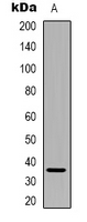 PEX2 / PAF-1 Antibody - Western blot analysis of PEX2 expression in HeLa (A) whole cell lysates.