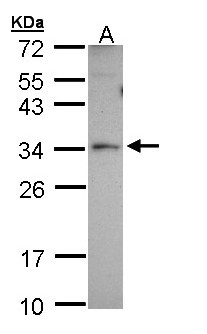 PEX26 Antibody - Sample (30 ug of whole cell lysate). A: A431. 12% SDS PAGE. PEX26 antibody diluted at 1:1000