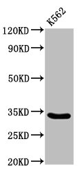 PEX26 Antibody - Positive Western Blot detected in K562 whole cell lysate. All lanes: PEX26 antibody at 3.4 µg/ml Secondary Goat polyclonal to rabbit IgG at 1/50000 dilution. Predicted band size: 34, 29 KDa. Observed band size: 34 KDa
