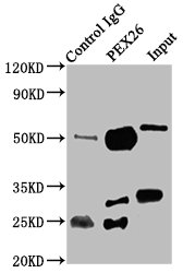 PEX26 Antibody - Immunoprecipitating PEX26 in K562 whole cell lysate Lane 1: Rabbit control IgG instead of PEX26 Antibody in K562 whole cell lysate.For western blotting, a HRP-conjugated Protein G antibody was used as the secondary antibody (1/2000) Lane 2: PEX26 Antibody (6µg) + K562 whole cell lysate (500µg) Lane 3: K562 whole cell lysate (20µg)