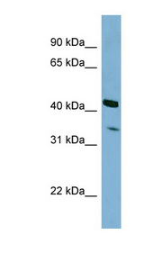 PEX26 Antibody - PEX26 antibody Western blot of HepG2 cell lysate. This image was taken for the unconjugated form of this product. Other forms have not been tested.
