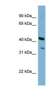 PEX26 Antibody - PEX26 antibody Western blot of HepG2 cell lysate. This image was taken for the unconjugated form of this product. Other forms have not been tested.